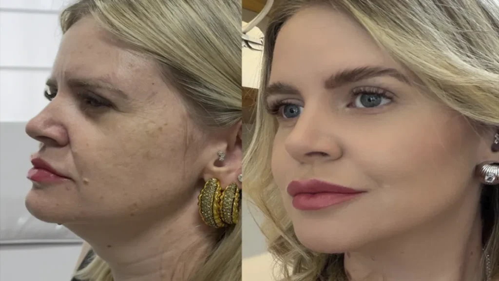Estética regenerativa: o novo luxo natural
