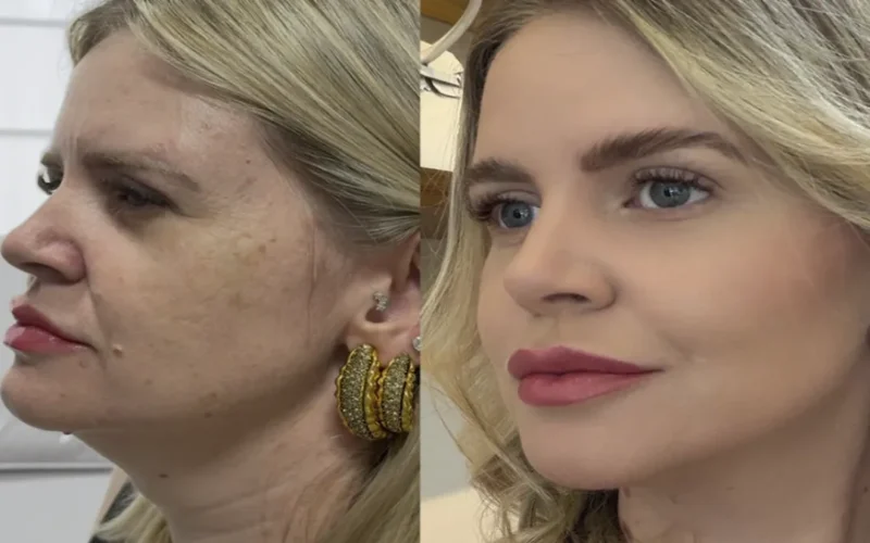 Estética regenerativa: o novo luxo natural