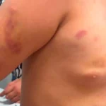 Padrasto preso após menina autista de 6 anos dar entrada no hospital com ferimentos