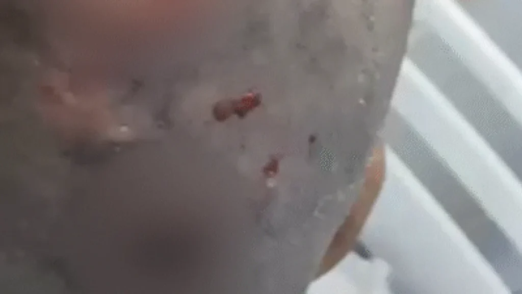 Mulher com larvas na cabeça é resgatada e polícia apura estupro