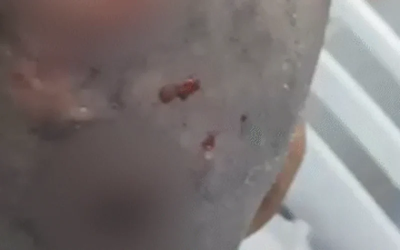 Mulher com larvas na cabeça é resgatada e polícia apura estupro